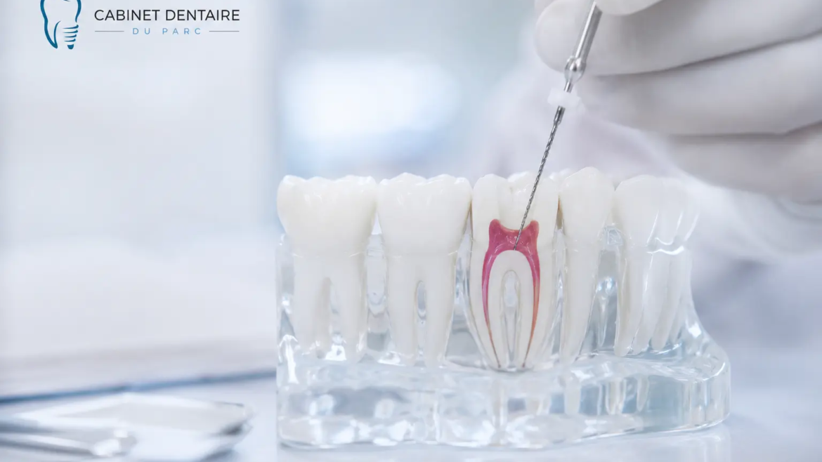 Pourquoi dévitaliser une dent et comment ça se passe ?