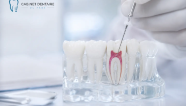 Pourquoi dévitaliser une dent et comment ça se passe ?