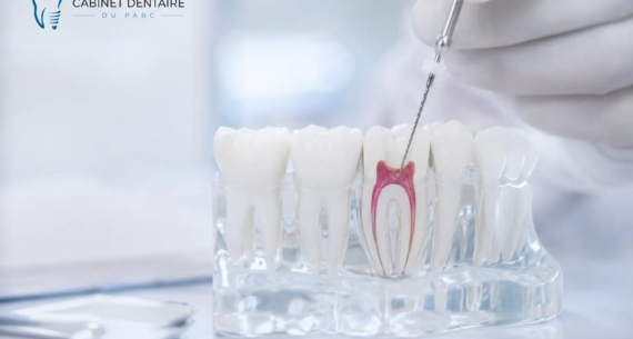 Pourquoi dévitaliser une dent et comment ça se passe ?