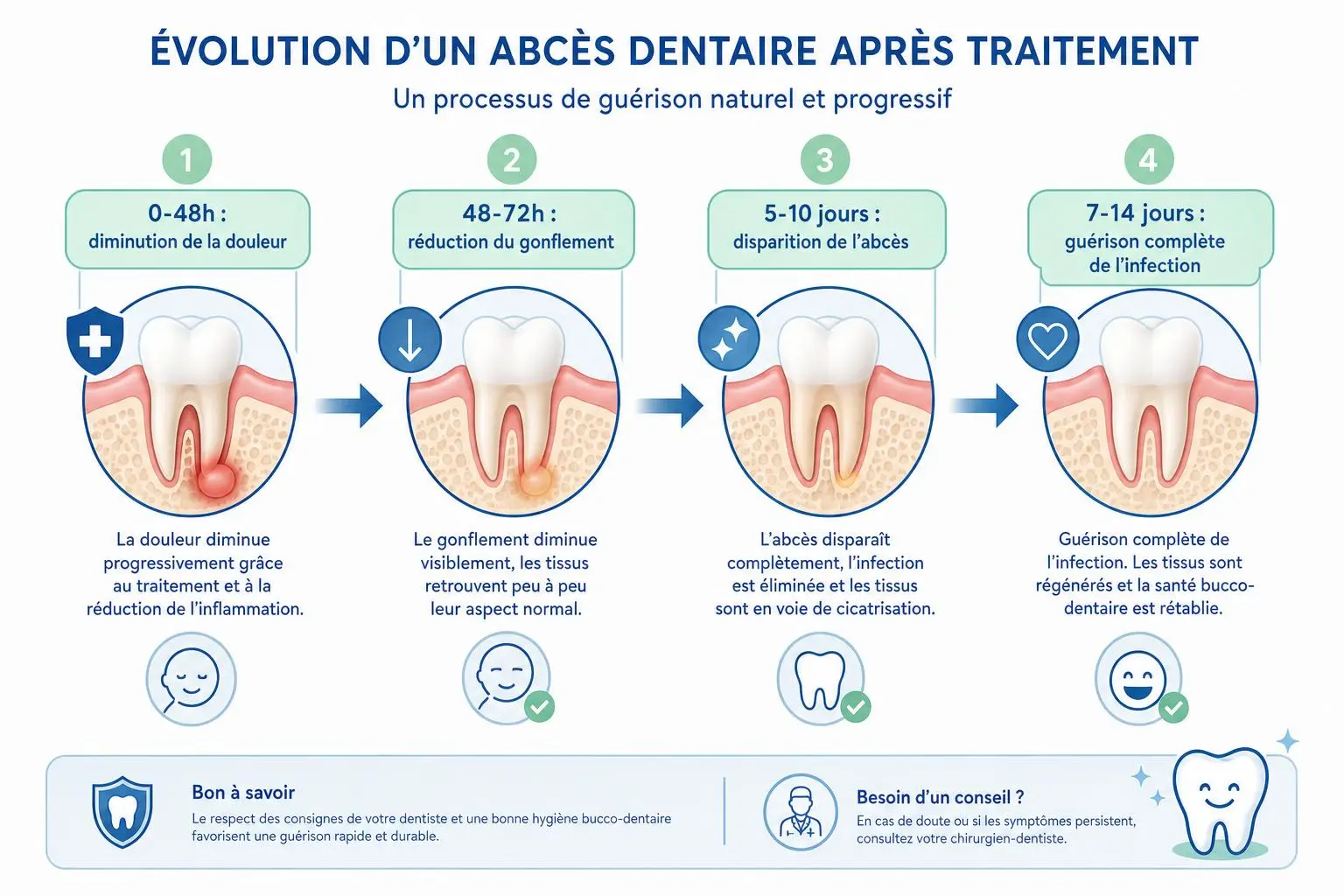 Évolution d’un abcès dentaire après traitement: réduction de la douleur puis diminution du gonflement, disparition de l’abcès et guérison complète de l’infection en 7–14 jours. Incorporation du mot-clé: en combien de temps disparaît un abcès dentaire.